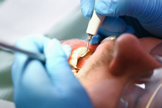 Best Emergency Orthodontic Repairs in Estero, FL
